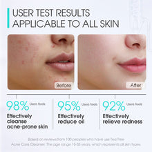 Load image into Gallery viewer, Tea Tree Acne Care Facial Cleanser
